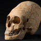 Illustration for article titled French Archaeologists Discover Beautifully Preserved Deformed Skull